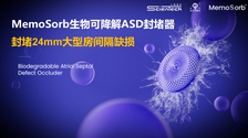 MemoSorb生物可降解ASD封堵器成功封堵24mm大型房间隔缺损