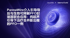 PannaWire介入引导导丝与生物可降解PFO封堵器联合应用：纯超声引导下治疗合并膨出瘤的PFO一例