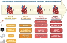 临床共识声明 | 心血管多模态成像在法布雷病评估中的作用