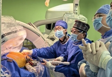 破解二次开胸风险！中山大学孙逸仙纪念医院郑俊猛教授团队巧用ScienCrown瓣膜完成一例高难度TMVI ViV手术