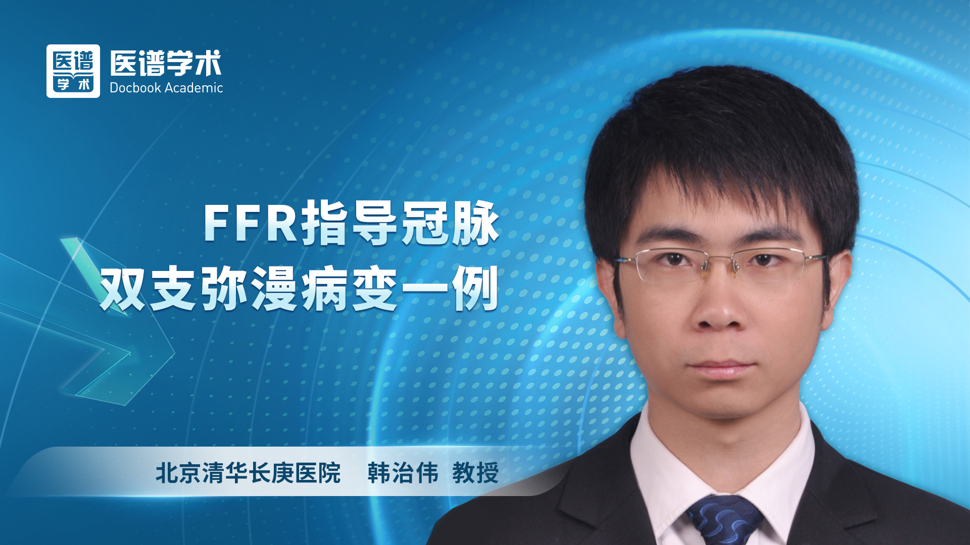 韩治伟-FFR指导冠脉双支弥漫病变一例